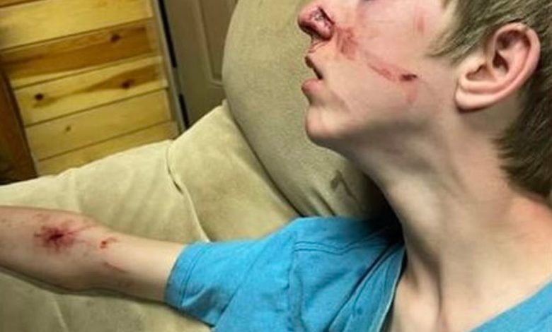 Teen survives terrifying bear attack thanks to his brother