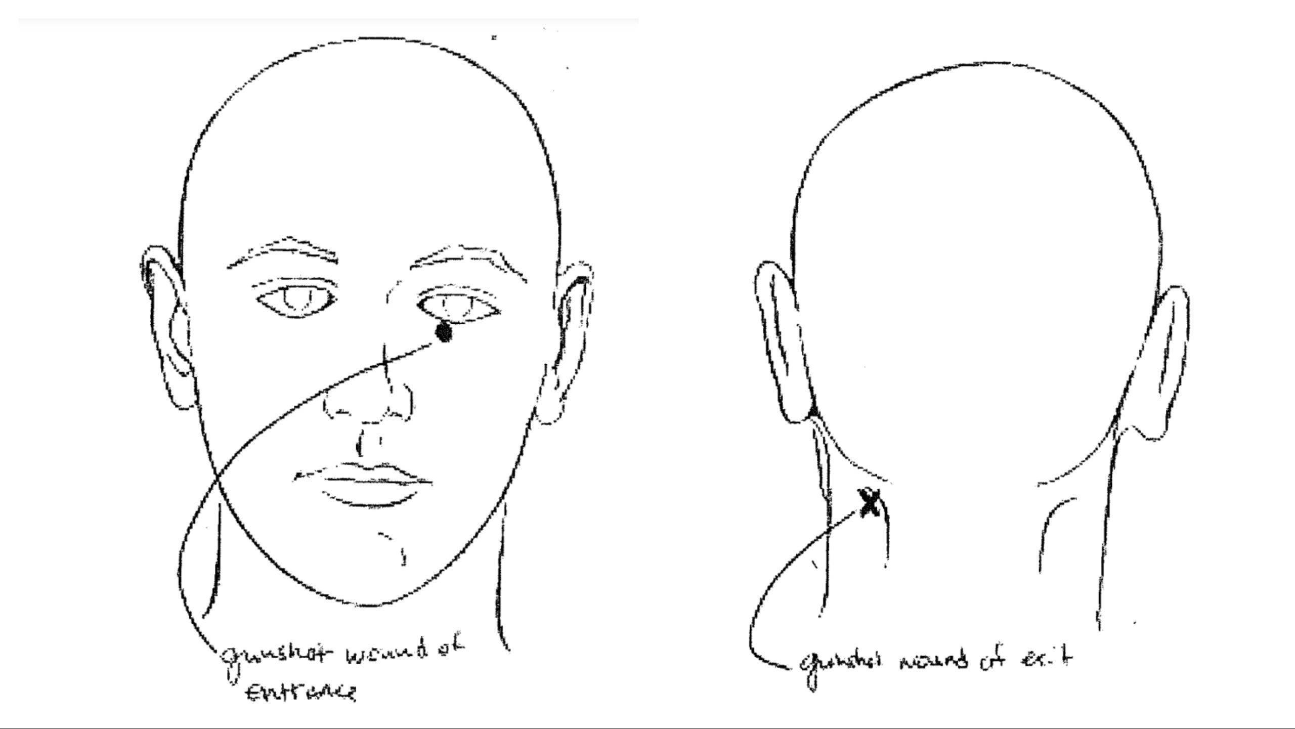 Sonya Massey was shot just below the left eye, with the round exiting through the back of her neck, according to the Sangamon County Coroner’s Office