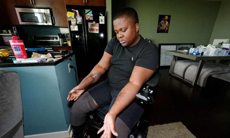 Recruit lost both legs in ‘barbaric’ police academy hazing ritual