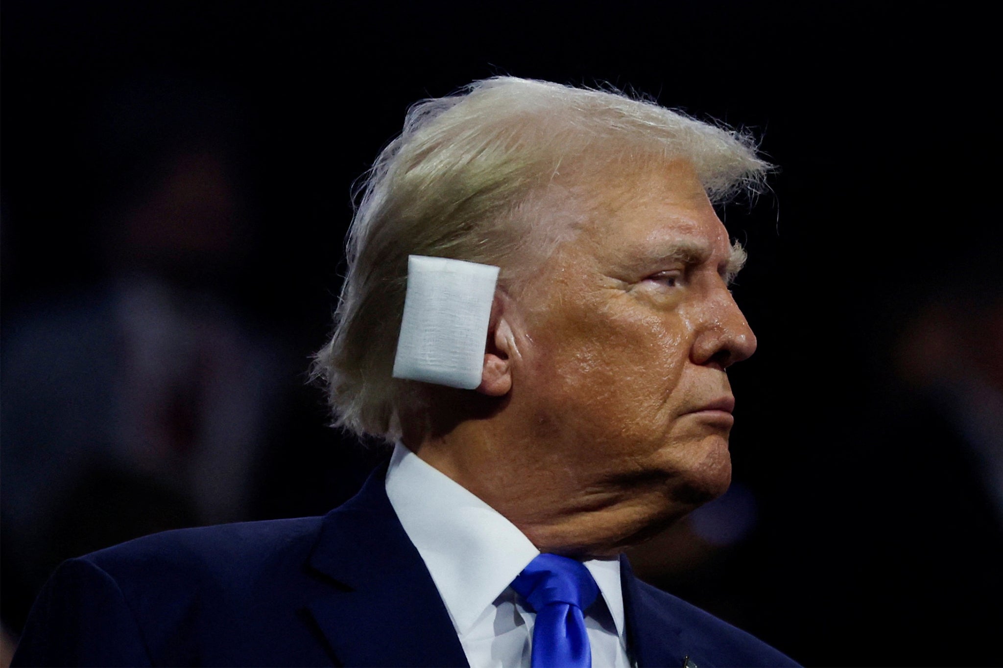 Donald Trump sports an ear bandage on day two of the convention