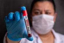 New Mpox Outbreak In Africa Leads To Cases In The U.S.