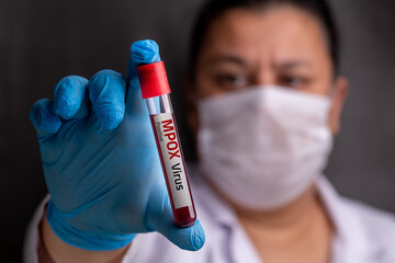 New Mpox Outbreak In Africa Leads To Cases In The U.S. New Mpox Outbreak In Africa Leads To Cases In The U.S.