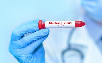 OUTBREAK ALERT: Marburg Virus In Ethiopia Kills 3 OUTBREAK ALERT: Marburg Virus In Ethiopia Kills 3