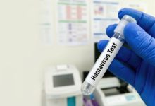 One American Tested “Mildly Positive” For Hantavirus