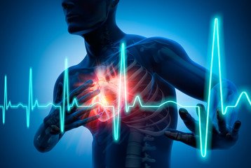 Antidepressant Use Tied to Sharp Rise in Sudden Cardiac Death Risk, Danish Study Finds