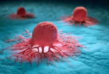 WHO Expects Cancer Cases To SOAR GLOBALLY