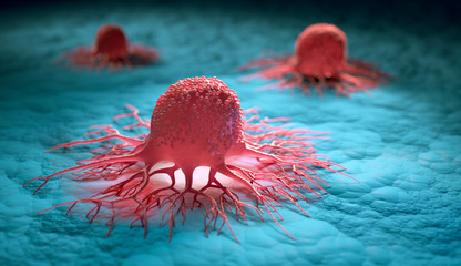 WHO Expects Cancer Cases To SOAR GLOBALLY